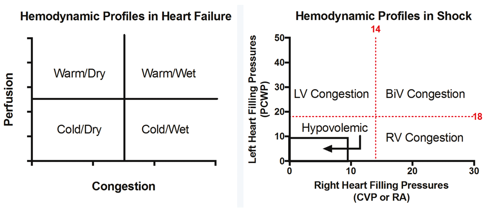 Acute Mechanical Circulatory Support For F1000research