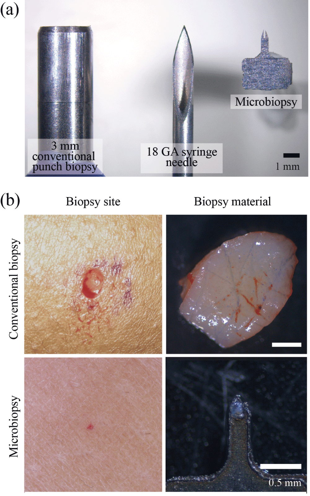 Microbiopsy engineered for minimally invasive and... F1000Research