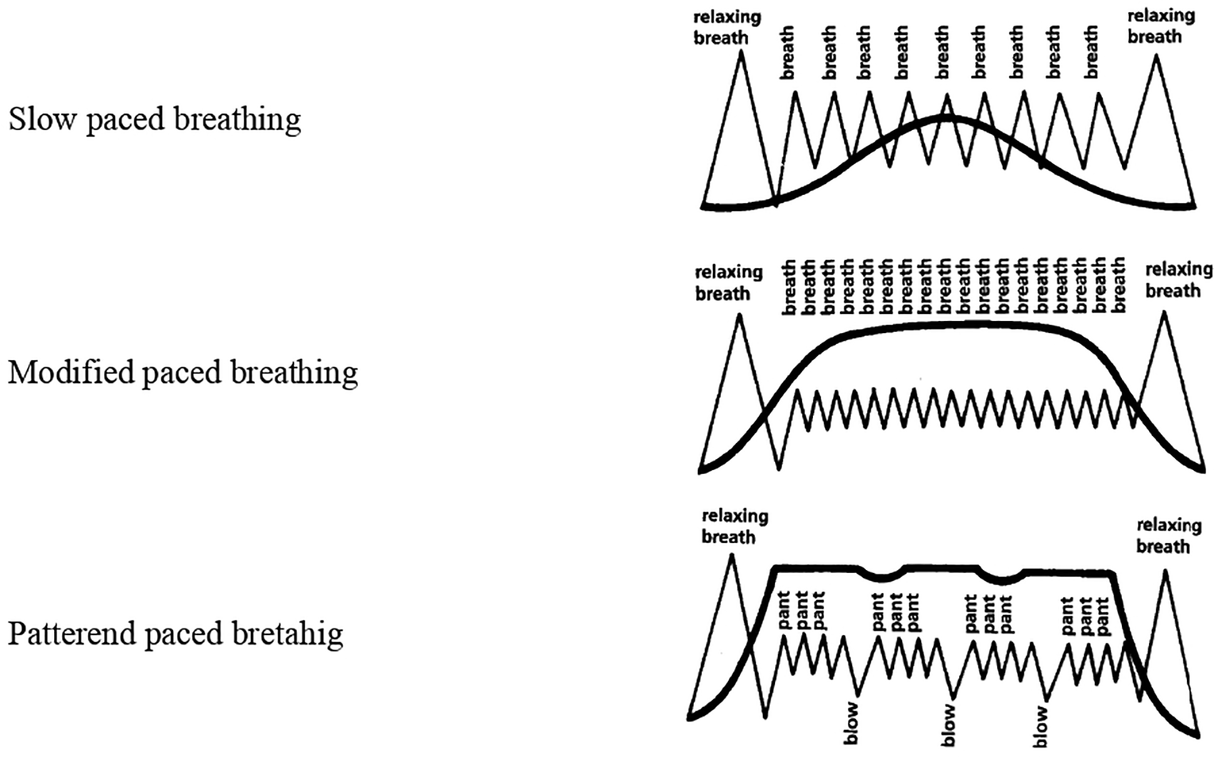 Snose Randomization Effectiveness of antepartum breathing exercises... | F1000Research