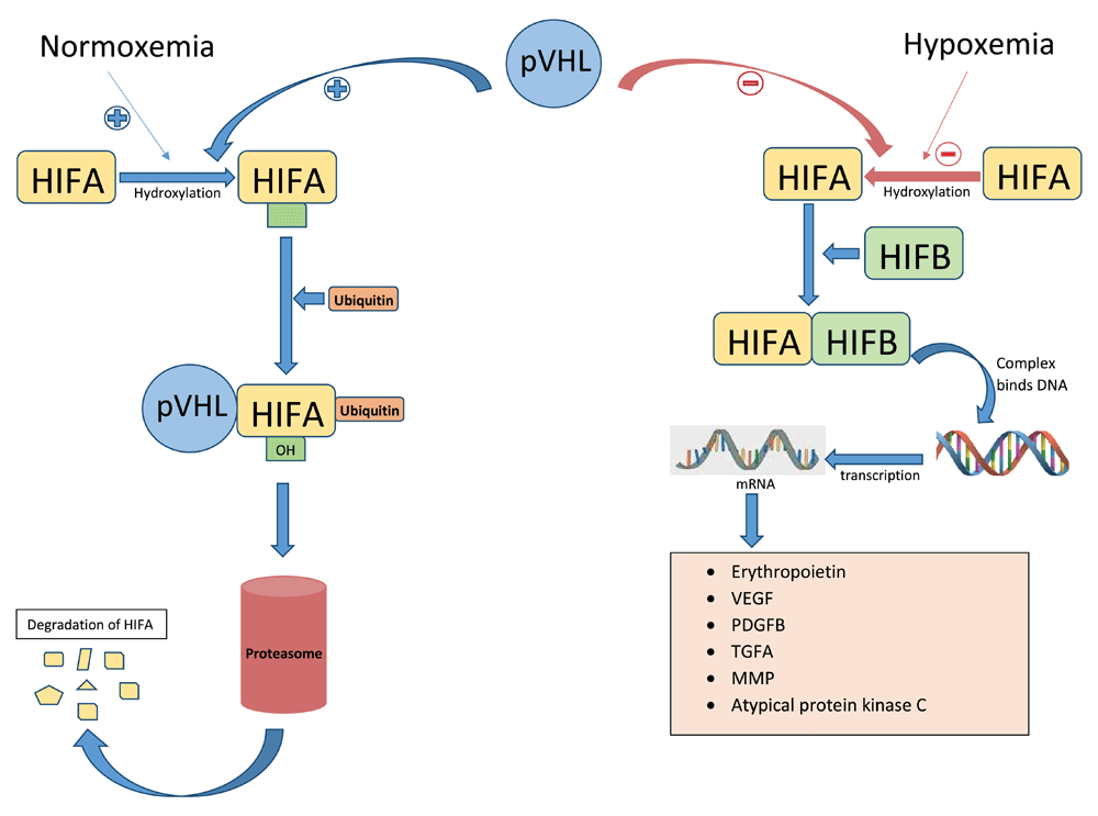 Renal cell carcinoma a review of biology and... F1000Research