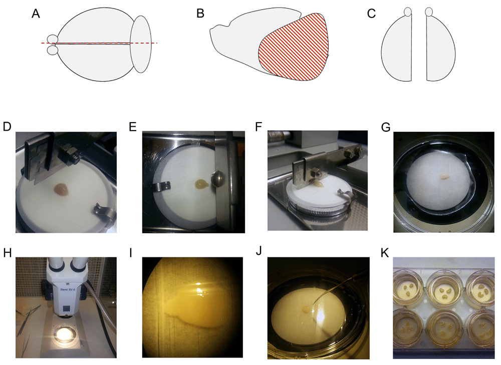 preparation of organotypic brain slice cultures for