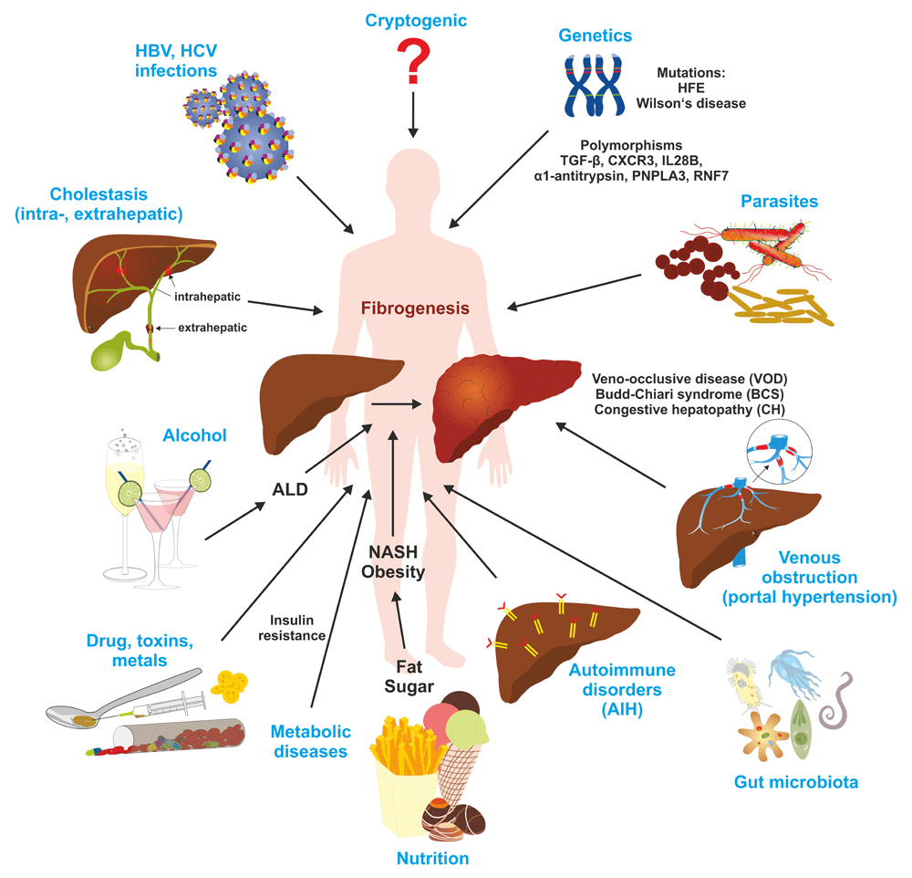 recent-advances-in-understanding-liver-fibrosis-f1000research