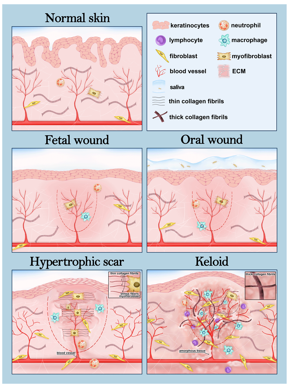 Scar Wound Drawing At Debra Cunningham Blog