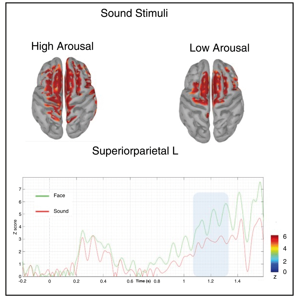 Thumbnail for Quality Equivalent Arousal Sound