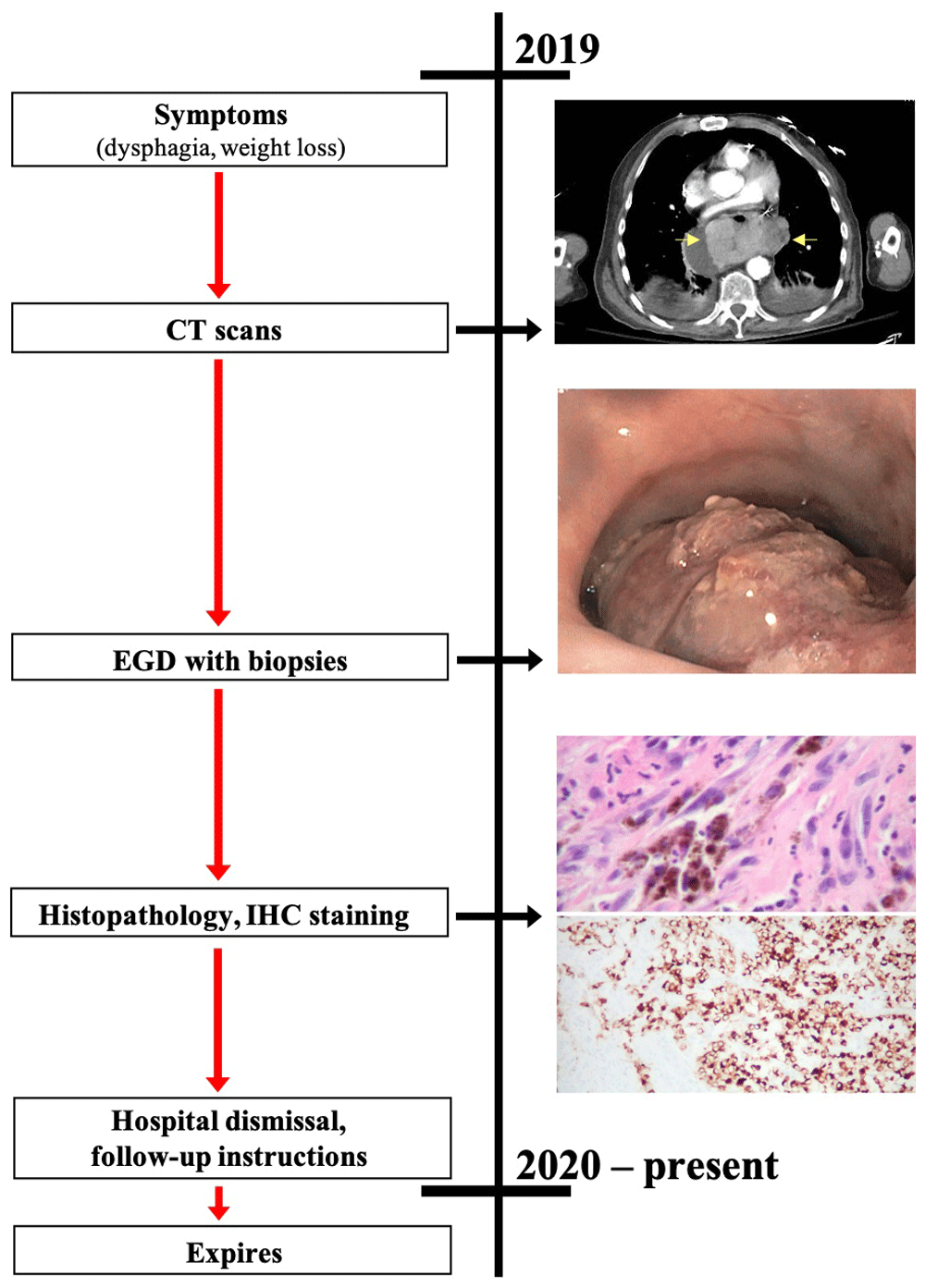 Case Report Primary melanoma of the... F1000Research