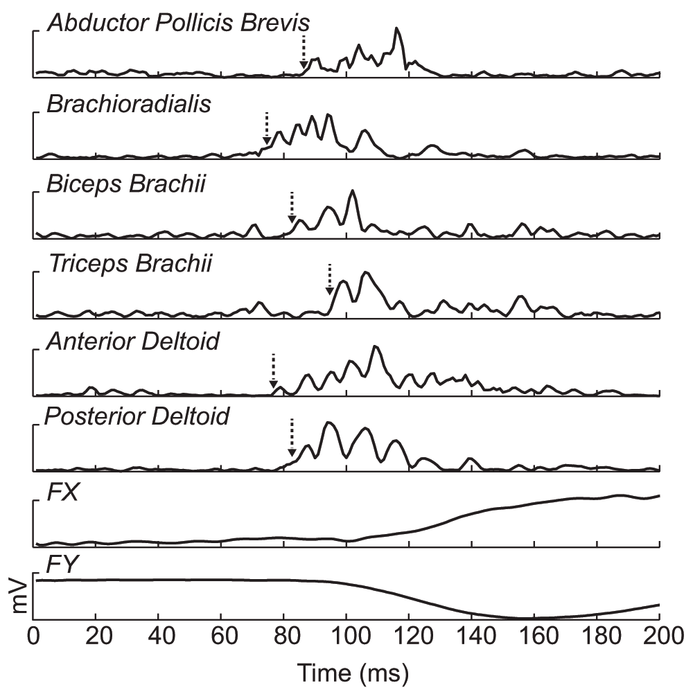 The Nociceptive Withdrawal Reflex Does Not Adapt To F1000research