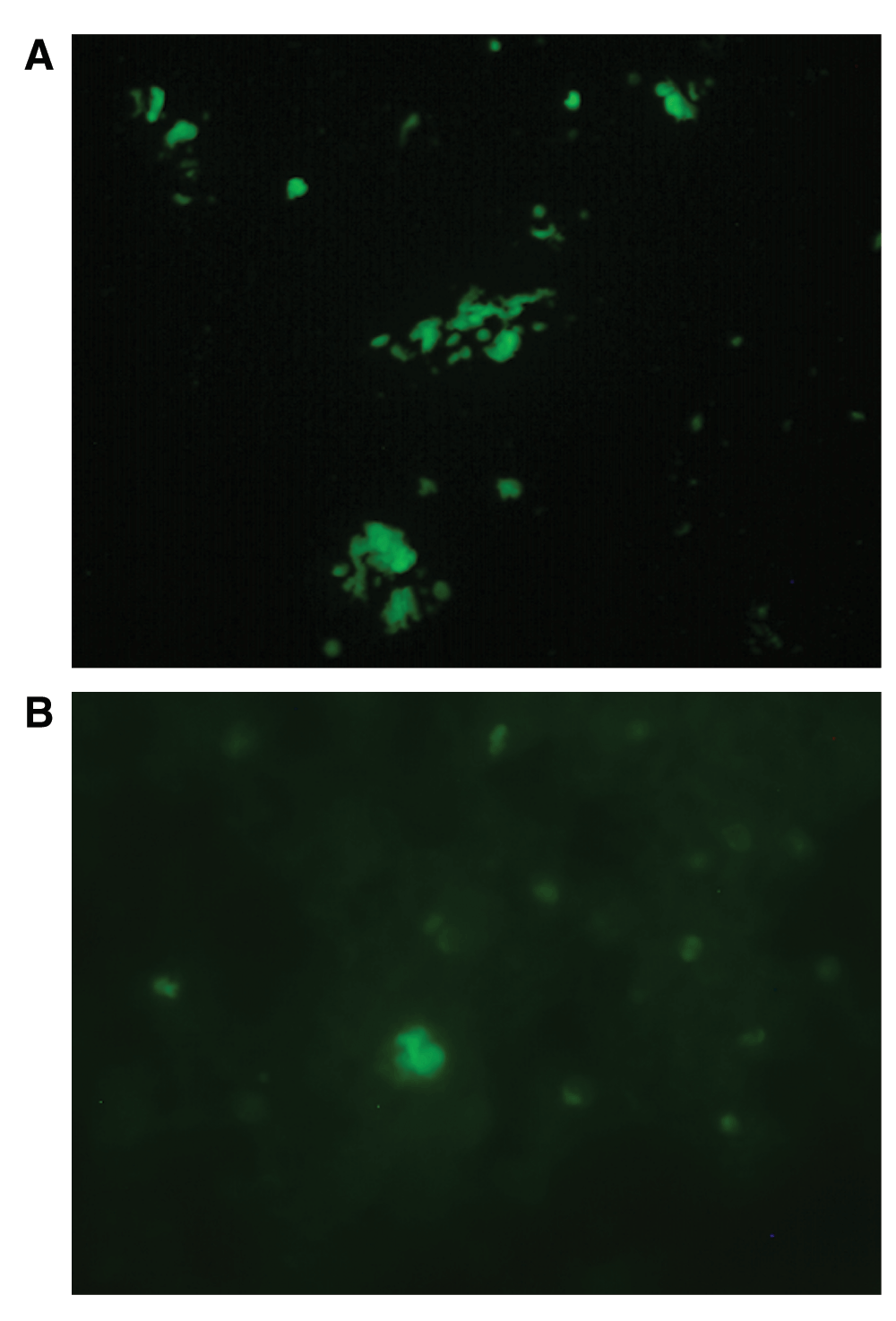 detection of borellia in urine breast milk Spicy asian viginas