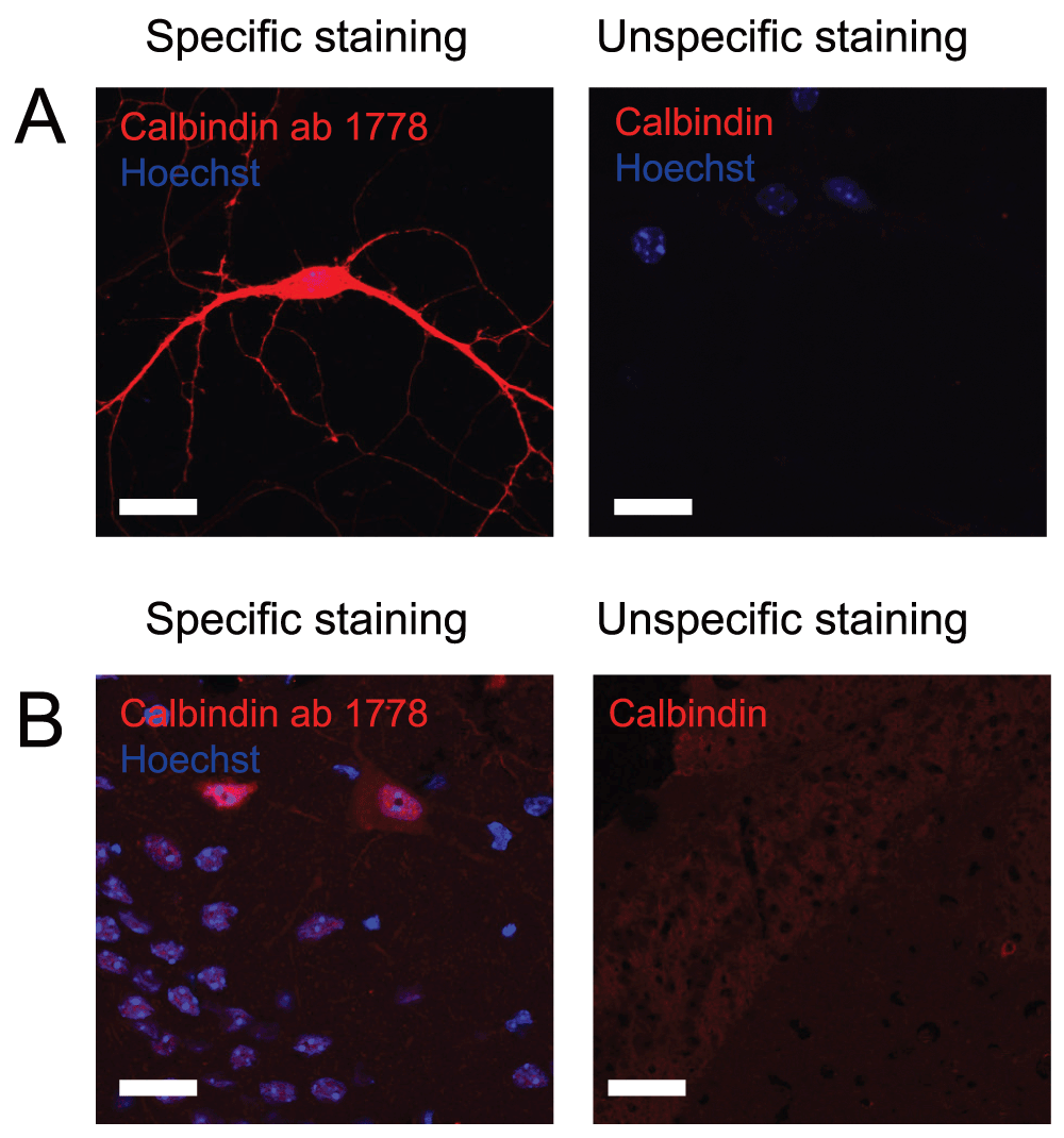 immunofluorescent visualization of mouse interneuron subtypes