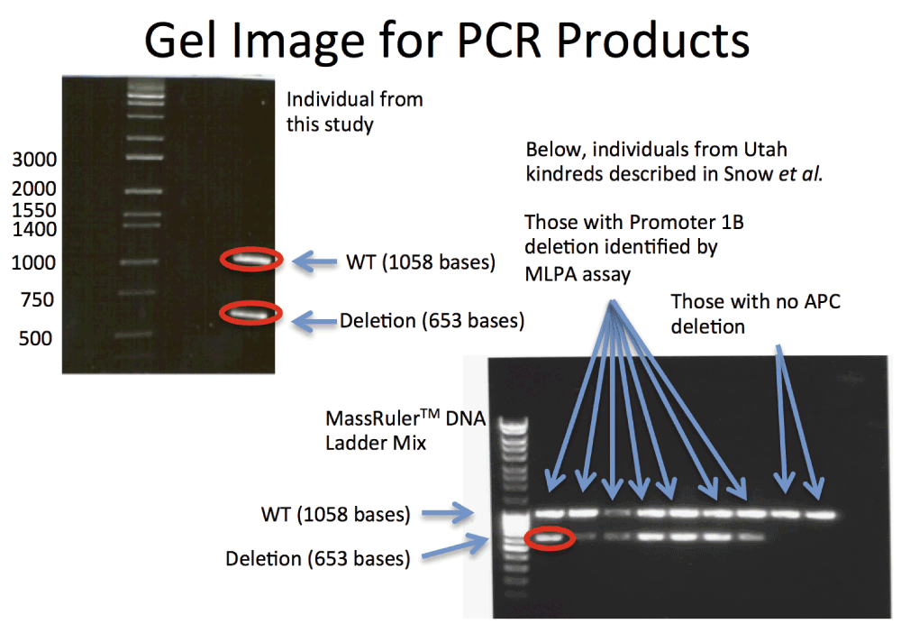 characterization of an apc promoter 1b deletion in a patient