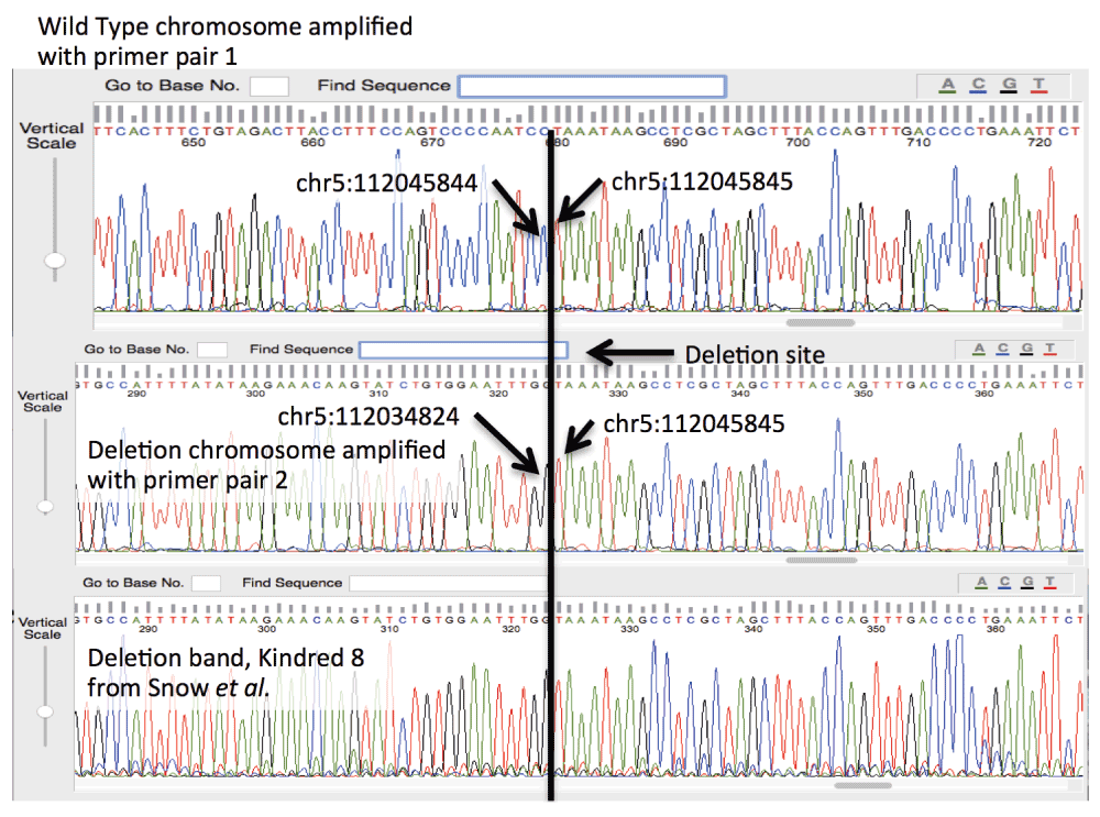 characterization of an apc promoter 1b deletion in a patient
