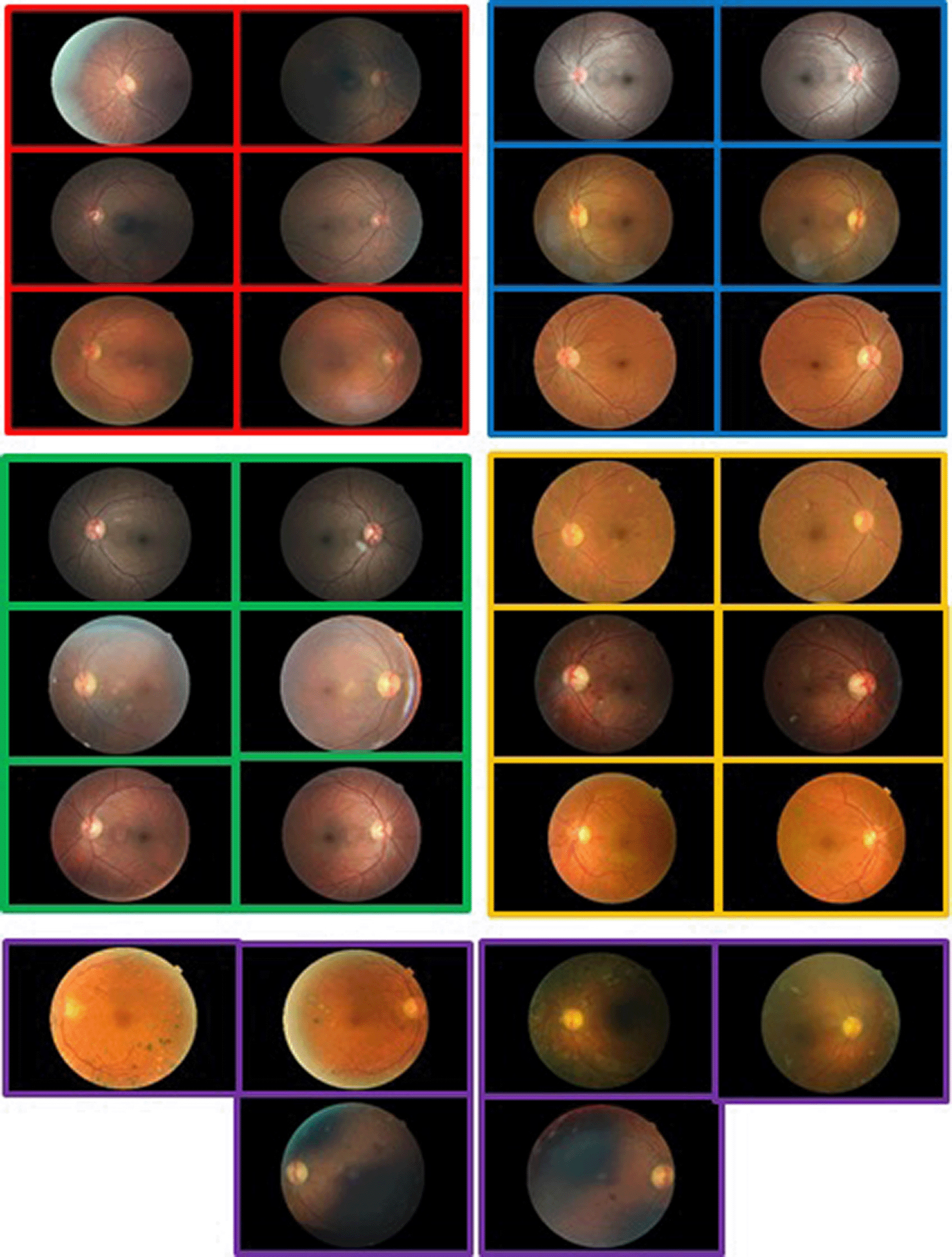 Encoding Retina Image to Words using Ensemble of... | F1000Research