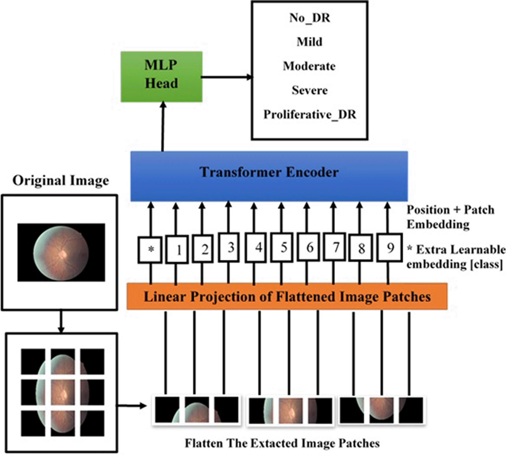 Encoding Retina Image to Words using Ensemble of... | F1000Research